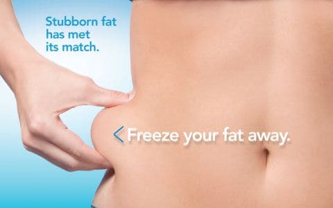 Hips treatment Ossett From Lipo Sculpt