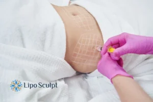 Are The Results From Aqualyx Permanent? 1 Do you want to know how long Aqualyx Ossett results last?