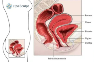 Treatment For A Leaky Bladder 2 How EM Chair treatment Ossett can help Leaky bladder issues. Read more now!