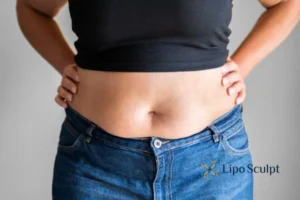 Bidding Farewell to Muffin Tops with Aqualyx Fat Injections 2 Do you wish you could reduce your muffin top Ossett With Aqualy fat dissolving injections you can!