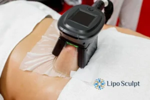 Does Fat Freezing At Home Work? 3 Fat freezing at home from Lipo Sculpt Ossett